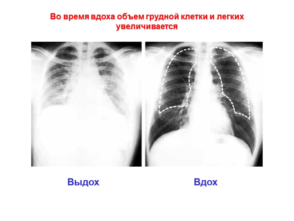 Во время вдоха объем грудной клетки и легких увеличивается Выдох Вдох